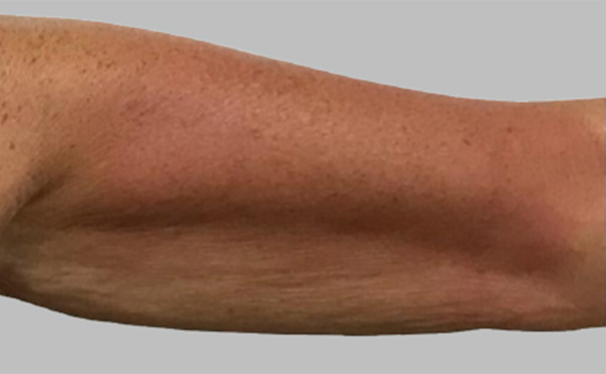 resultado-exilis-04-b